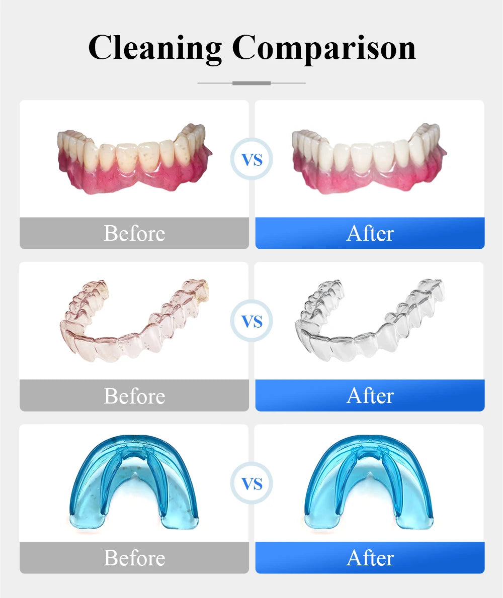 Tullker Ultrasonic Retainer Cleaner With UV Light Dentures Braces Jewelry
